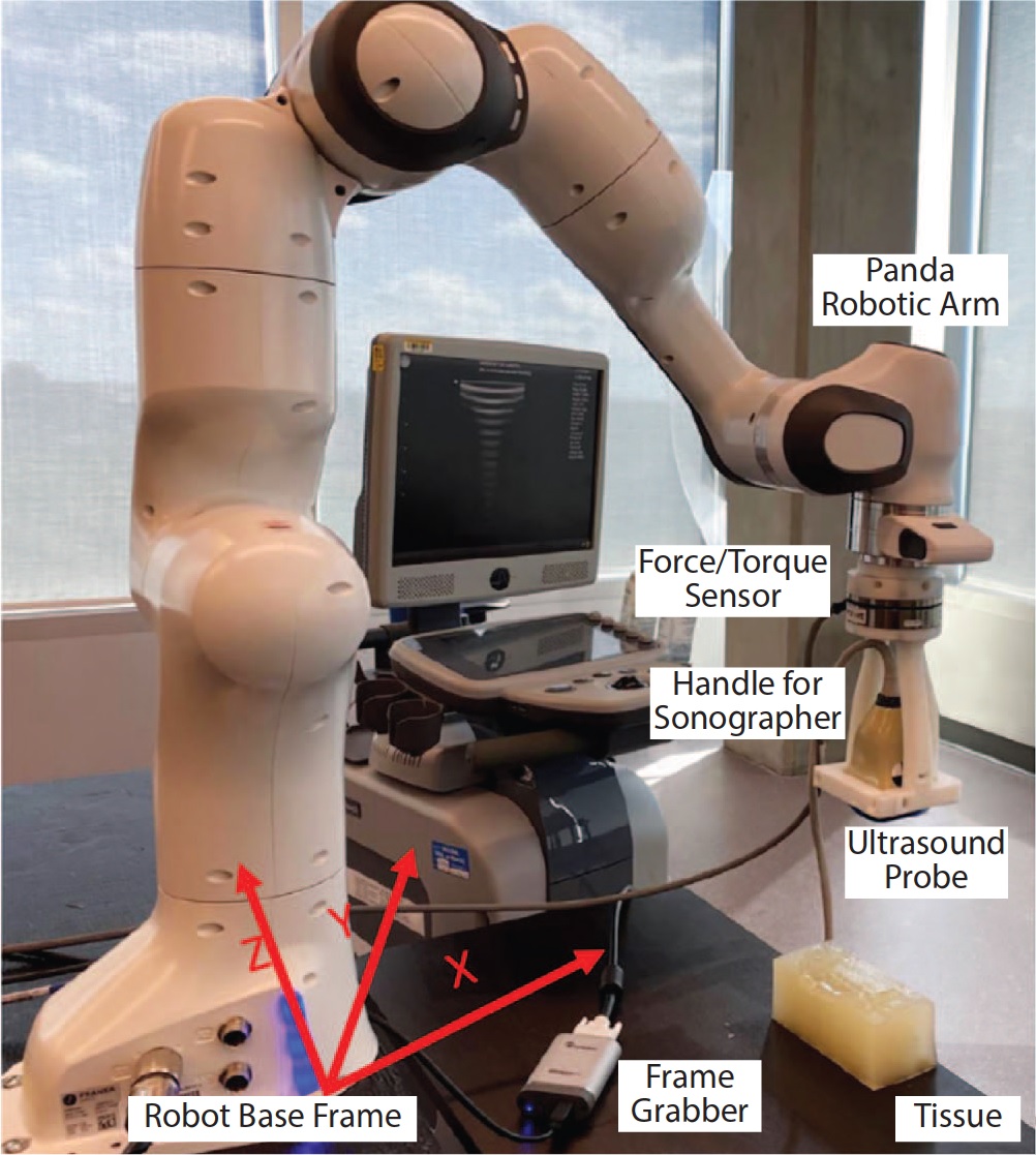 Robotic ultrasonic system Panda