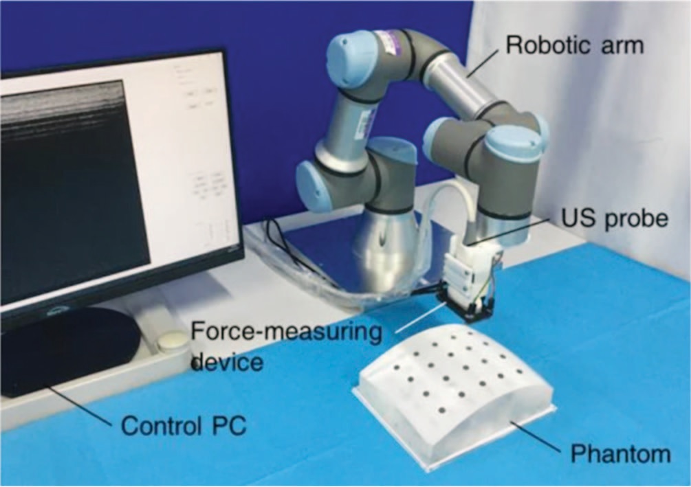 Роботическая УЗИ система с измерением силы с помощью волноводов 1