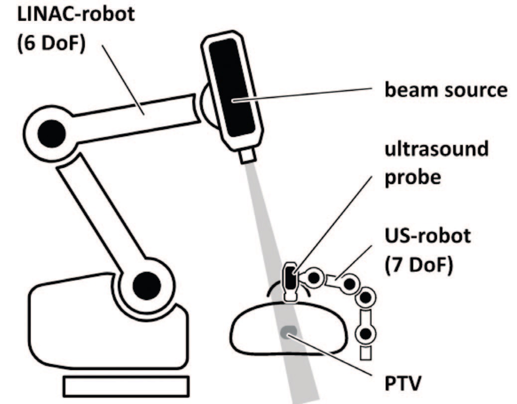 Robotic radiotherapy under ultrasound control 
