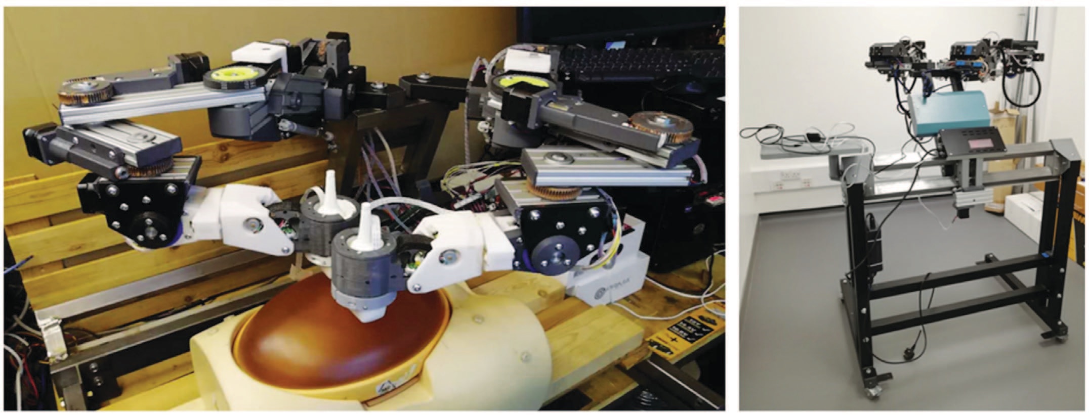iFIND-v3 робот: a. УЗИ фантома плода; b. система передвижения роботических рук