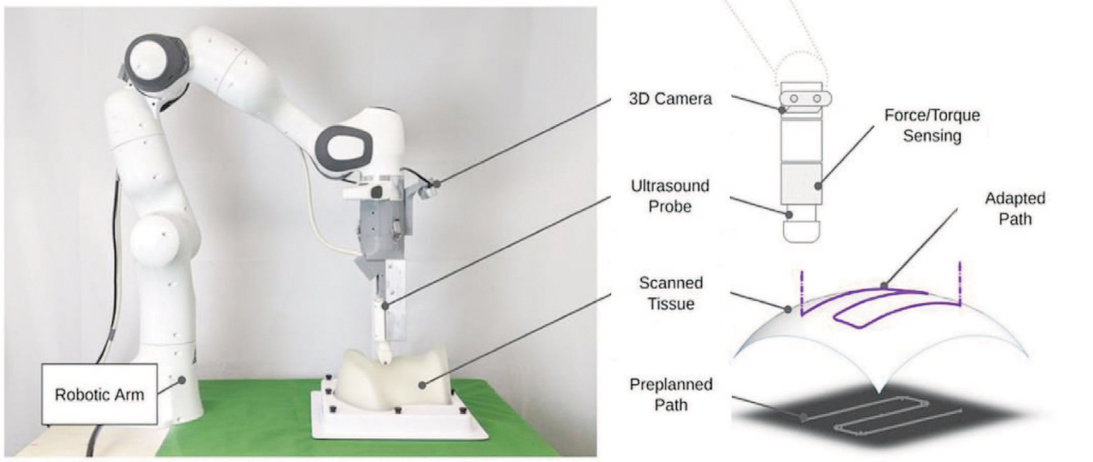 Robotic ultrasound system and its components