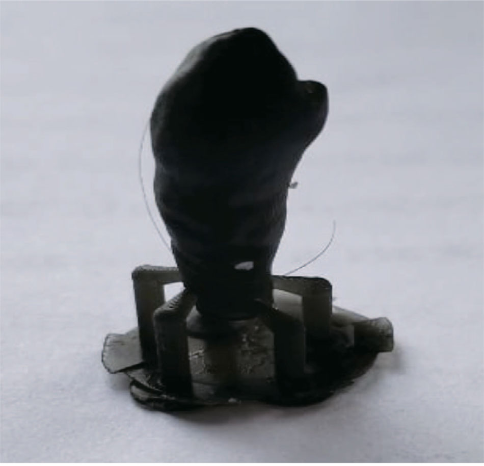 Напечатанная персонализированная 3D-модель зуба