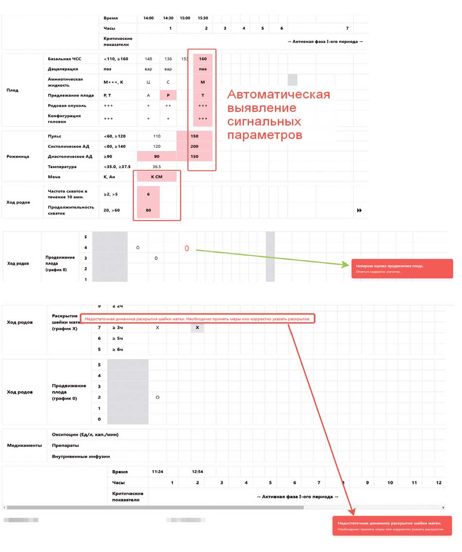 Цифровая партограмма